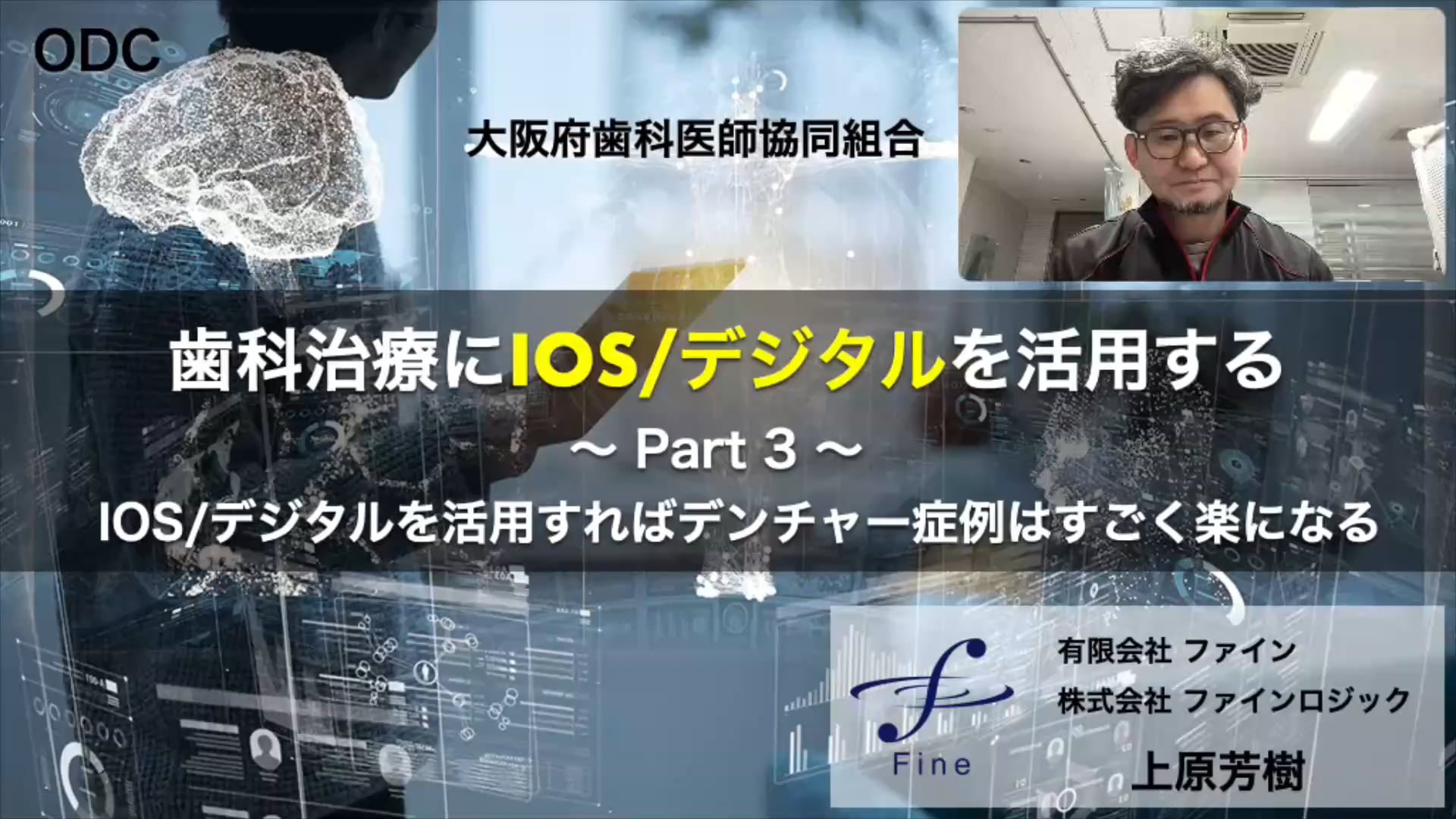歯科治療にIOS/デジタルを活用する＜Part.3＞ 講師：上原芳樹先生